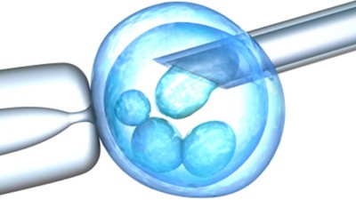 Transferencia de embriones congelados