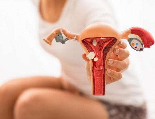 ¿Cuáles son las consecuencias de la endometriosis ovárica?