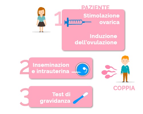 fasi dell'inseminazione artificiale con lo sperma del partner