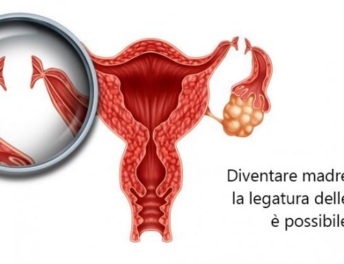 Diventare madre dopo la legatura delle tube è possibile