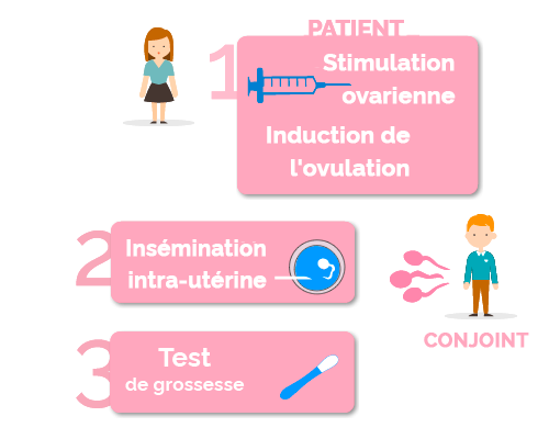 fases de la inseminación artificial con semen de la pareja