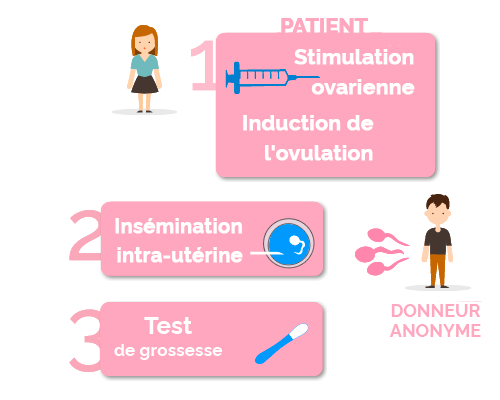 fases de la inseminación artificial con semen de donante anónimo