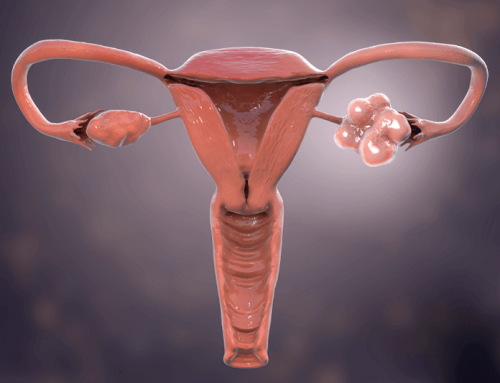 Síndrome de Ovarios Poliquísticos (SOP): Todo lo que debes saber sobre esta condición